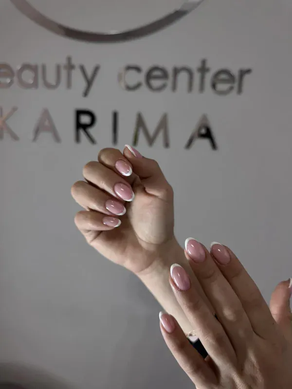 Резултати от козметичните процедури в beauty center Карима - снимка 8 от галерията