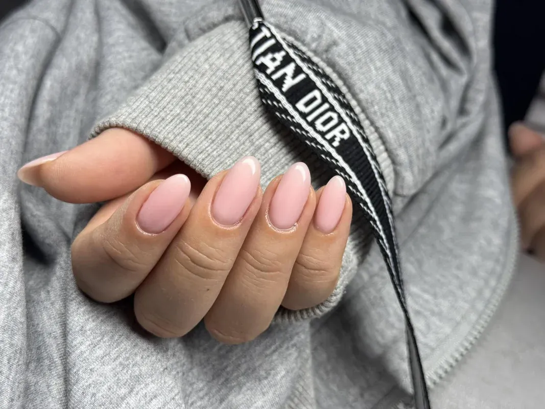 Резултати от козметичните процедури в beauty center Карима - снимка 14 от галерията